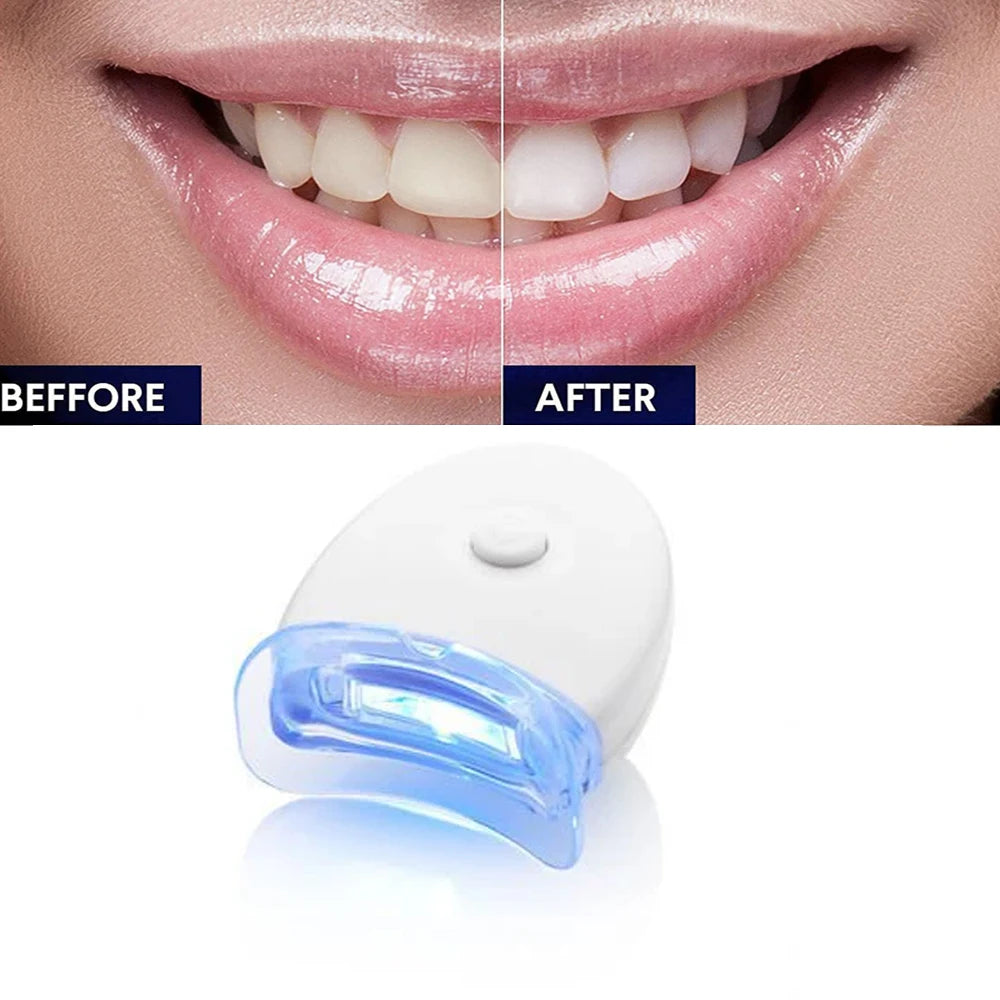 Home Teeth Whitening